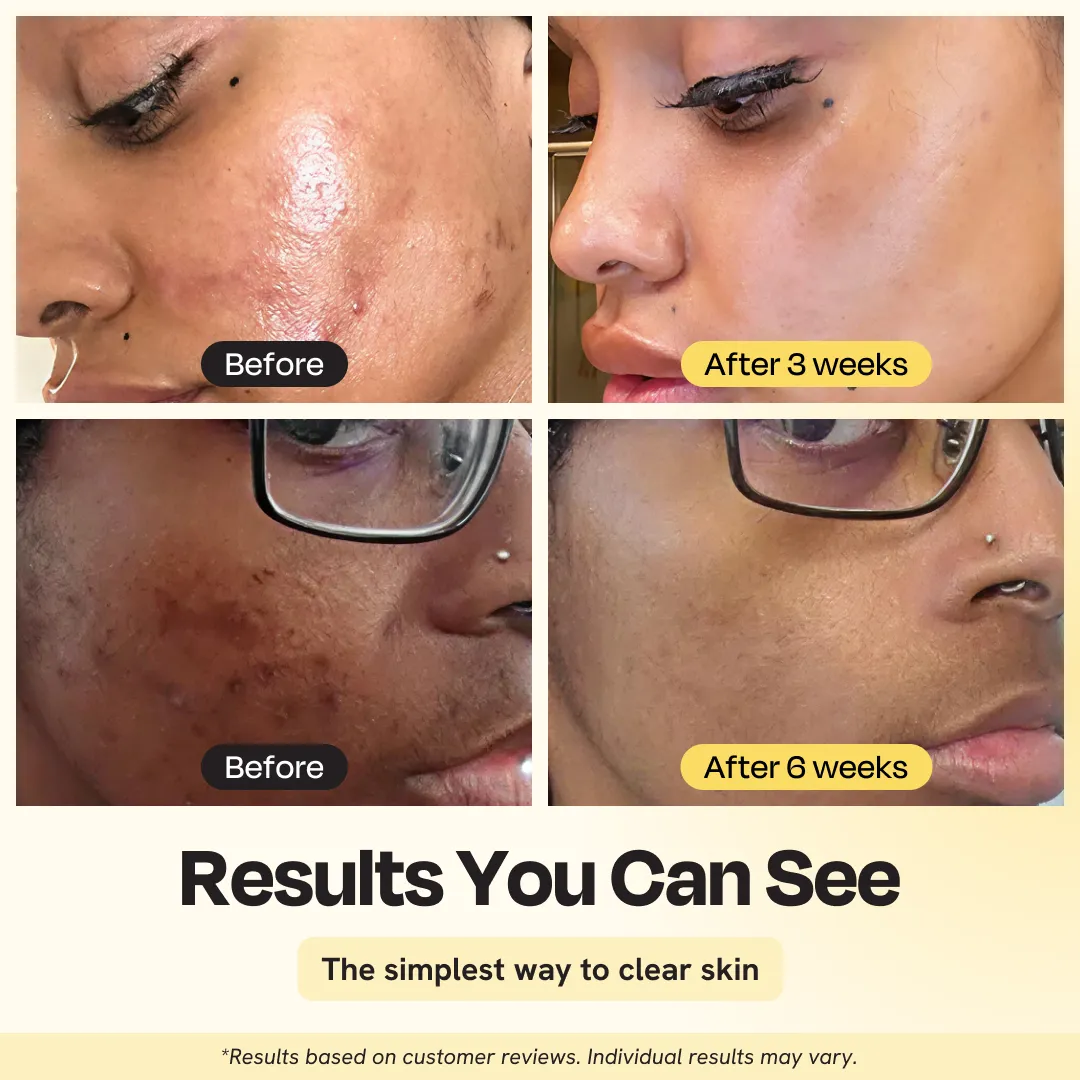 Vitamin C Clay Mask - Image 4